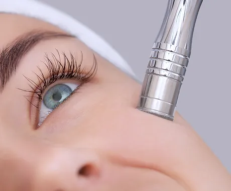 Microdermabrasion facial services near Nampa, ID